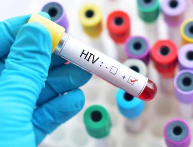 ΚΕΕΛΠΝΟ: Αύξηση των κρουσμάτων HIV στις ηλικίες 50-64